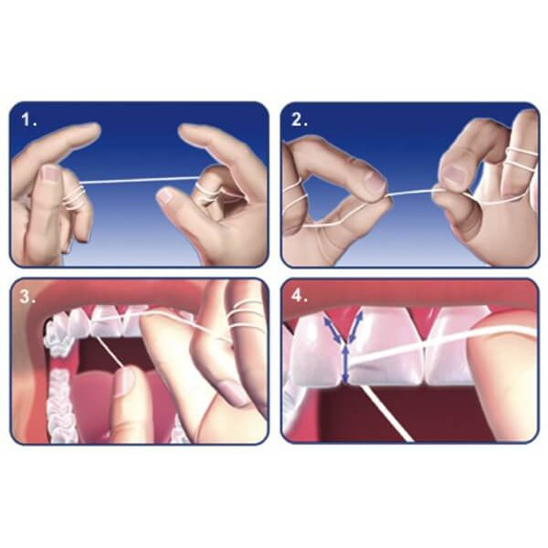 Chỉ Nha Khoa Donto Dent, hàng nội địa Đức