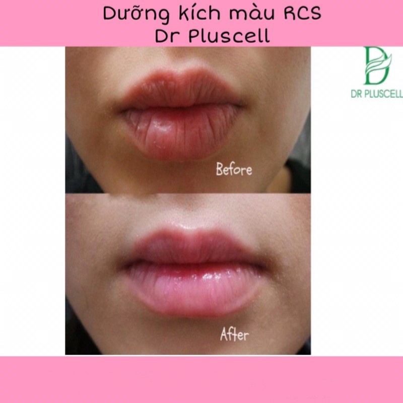 Dưỡng môi xăm, kích màu môi phun xăm dr pluscell rcs ampoule 2ml