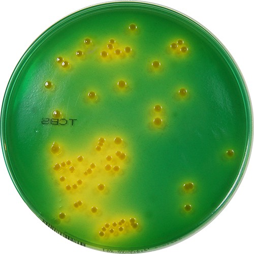 20 ĐĨA TEST KHUẨN TÔM CHỨA THẠCH MÔI TRƯỜNG TCBS PHÂN LẬP VIBRIO