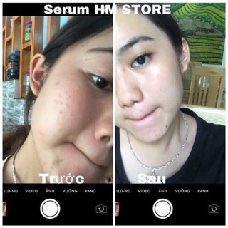 Face trắng hồng HM STORE