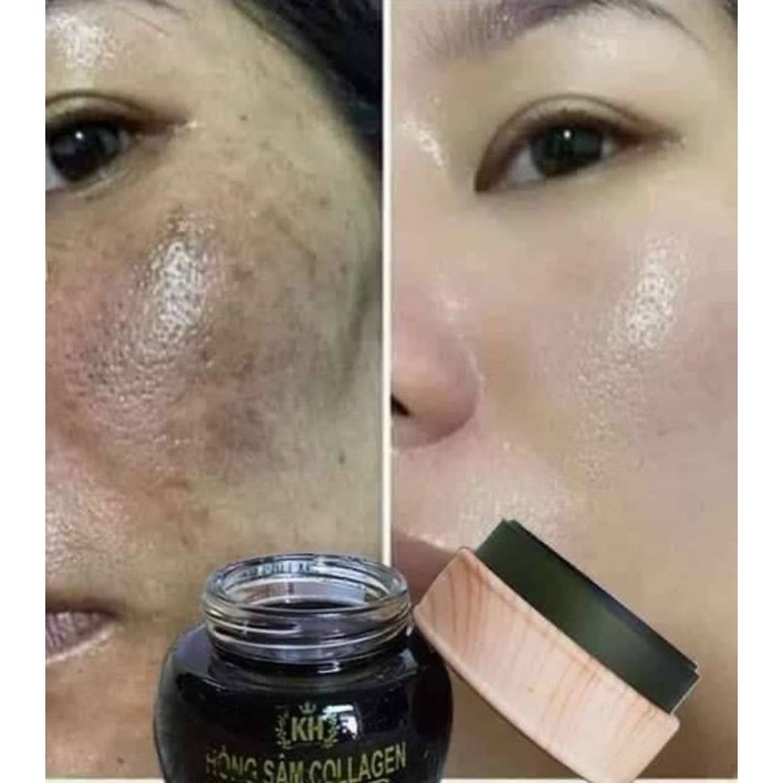 Mặt nạ hồng sâm Colagen Kim Hoàng.