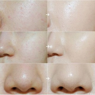 Bộ sản phẩm dưỡng da Innisfree Green Tea Balancing