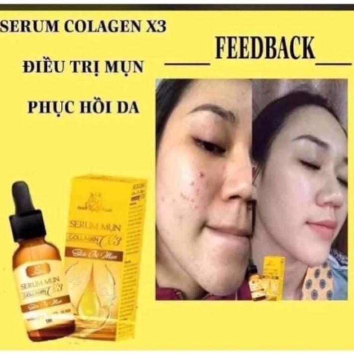Serum mU  n Collagen X3 Luxury mỹ phẩm Đông Anh Chính Hãng HÀNG CHÍNH HÃNG GIÁ RẺ XẢ KHO