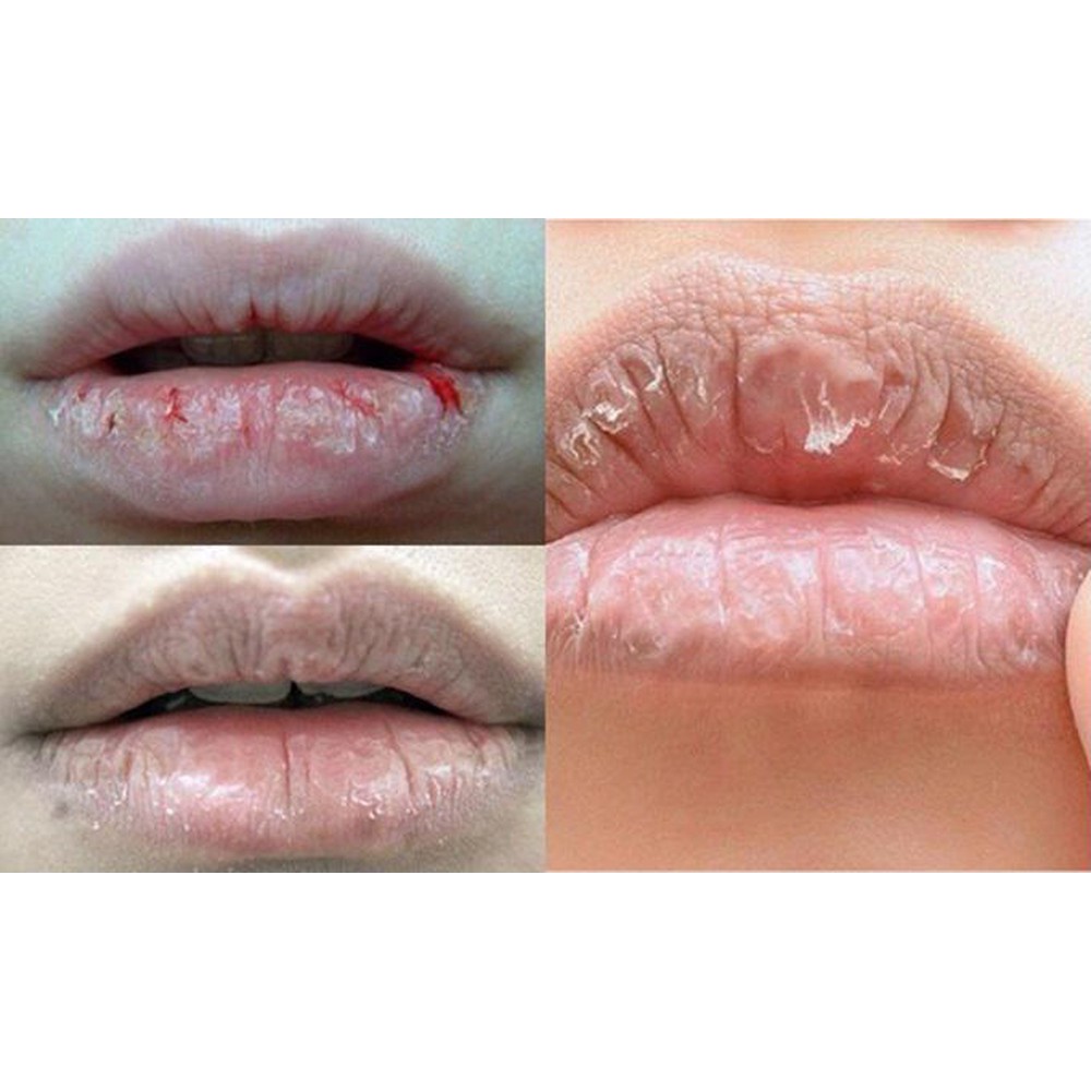 Son dưỡng không màu cấp ẩm, giúp môi không bị bong tróc nứt nẻ Lush Therapy Lip Essence dạng thỏi - Katta_V01_LG_015