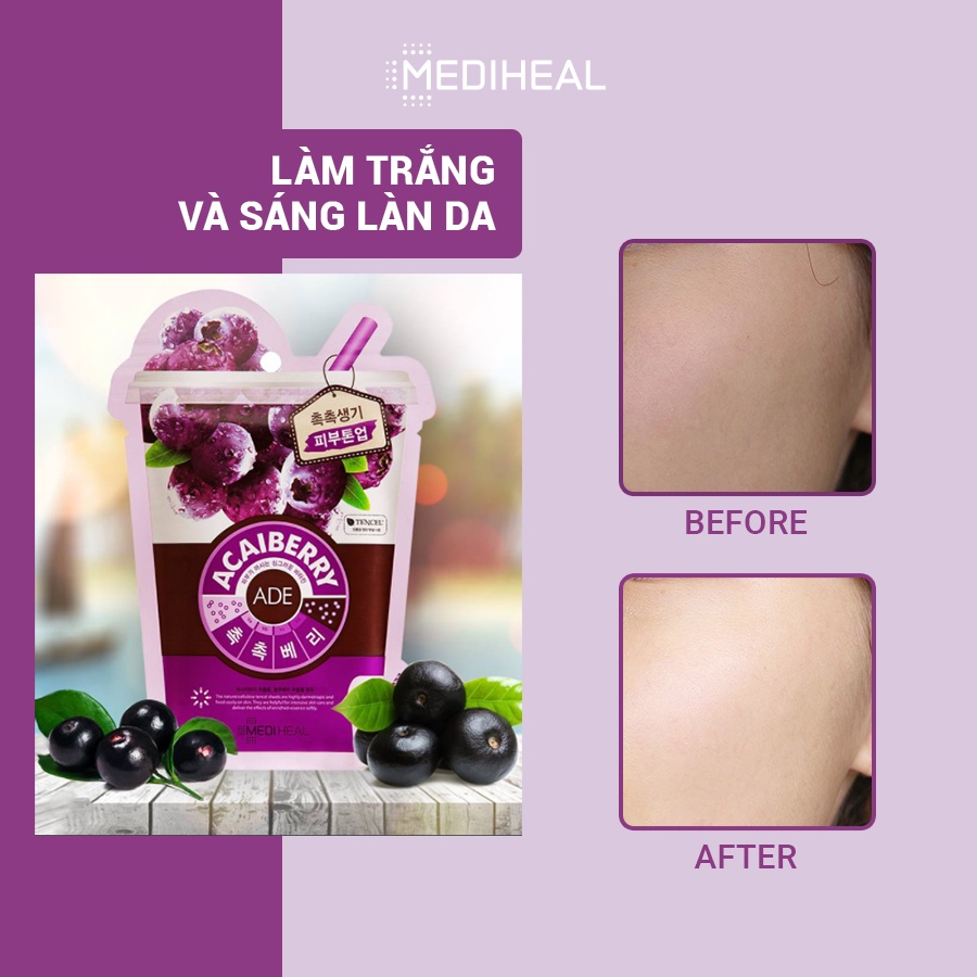 Mặt Nạ Tinh Chất Việt Quất Ngăn Ngừa Lão Hóa Da Mediheal Acaiberry Vita Mask 20ml [K16]