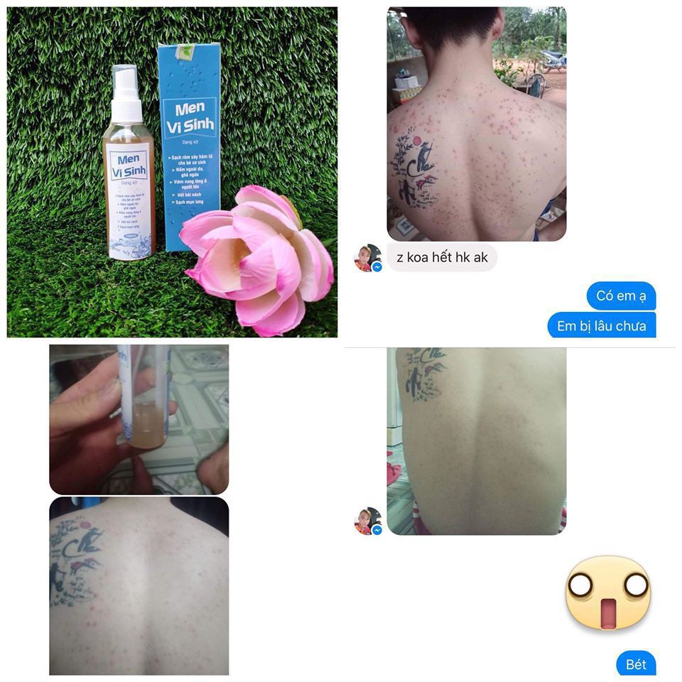 MEN VI SINH TAVIDA HẾT MỤN LƯNG, VIÊM NANG LÔNG, MẨN NGỨA | BigBuy360 - bigbuy360.vn