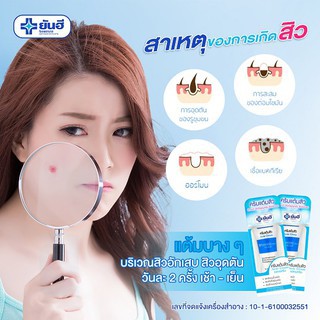 Chấm Mụn Yanhee Acne Cream Hàng Nội Địa Thái Lan 10gr