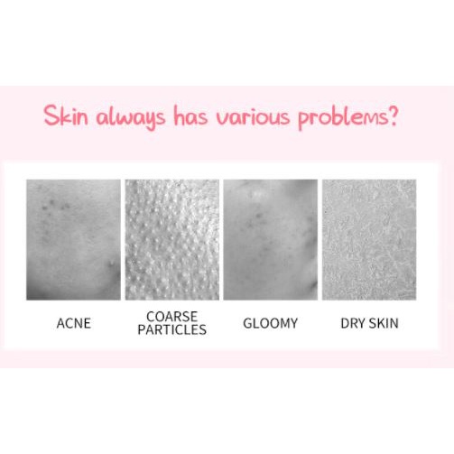 Gói Gel Tẩy Tế Bào Chết Đào Fenyi Skin Honey Peach 3g
