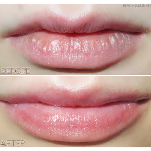 Son Dưỡng Môi Vaseline Lip Therapy Dạng Thỏi 4.8G