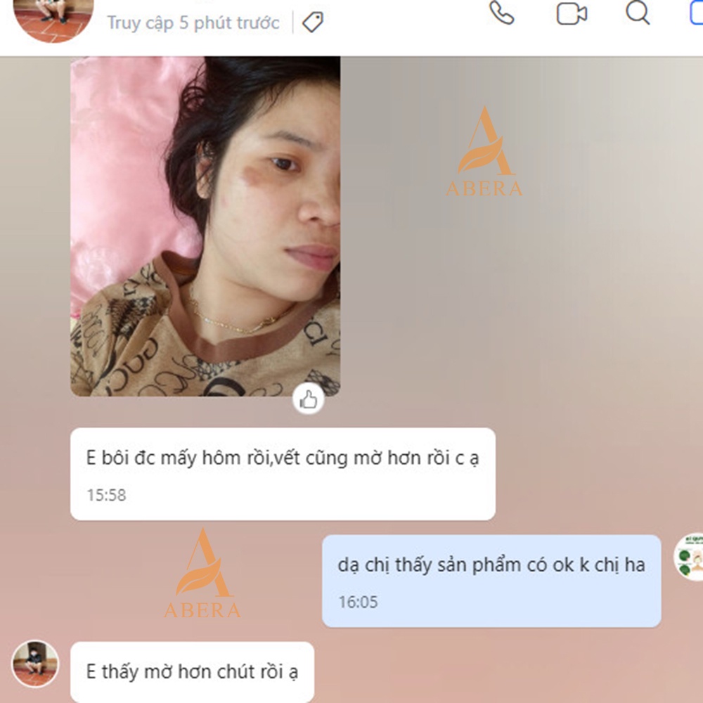 Kem Chống Nắng 3W Clinic & Serum Giảm Thâm Nghệ Đỏ Nano ABERA 15ml, Giảm thâm, chống nắng, bảo vệ da tối ưu