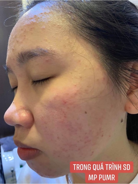 Cốt nhân sâm và kem face tối pumr