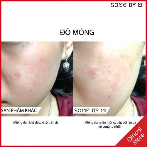 Miếng dán mụn Some By Mi Acnes Clear Patch gói 18 miếng | BigBuy360 - bigbuy360.vn