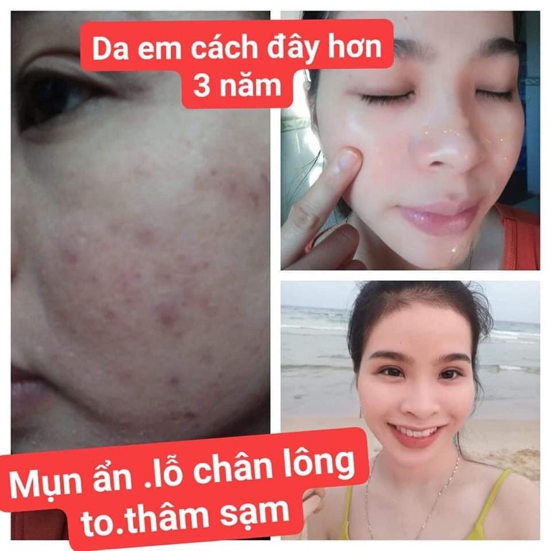 Đản bảo hiêu quả ngay từ bộ đâu tiên AMY COLAGEN