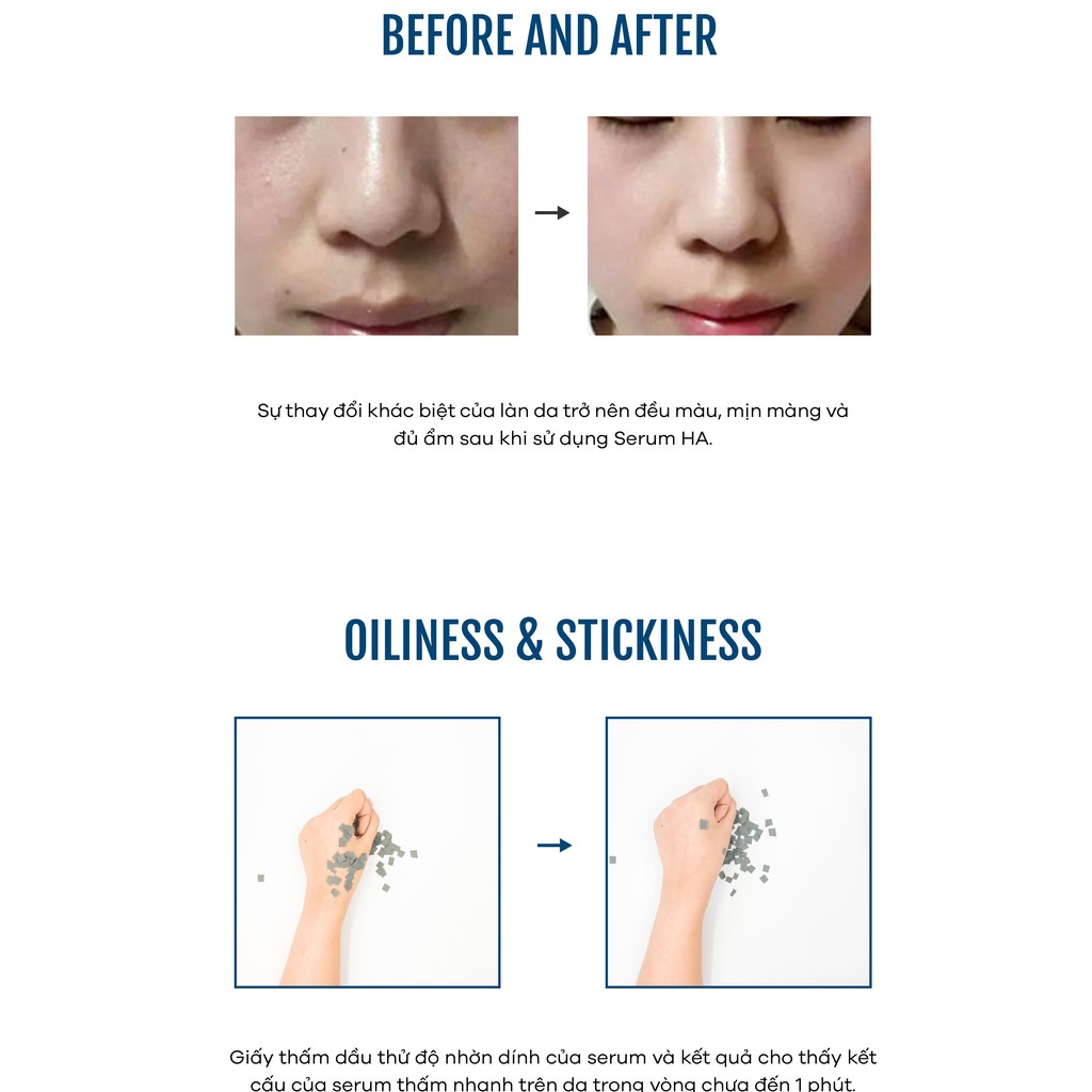 Serum (Tinh Chất) Cấp Nước Zakka Naturals Super Hyaluronic Vitamins Serum 30ml | BigBuy360 - bigbuy360.vn