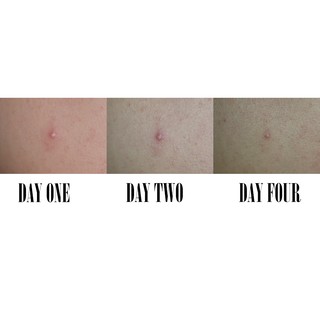 Fullsize 29ml Chấm mụn MARIO BADESCU Drying Lotion