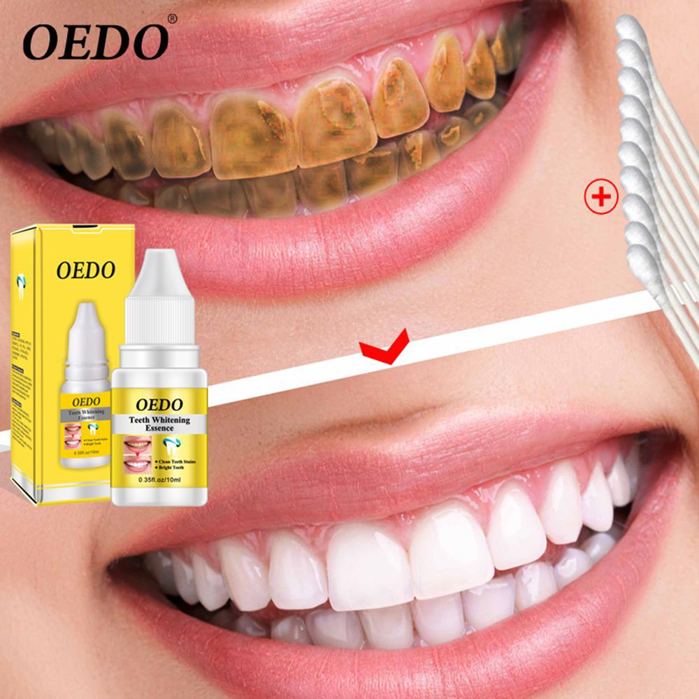 TẨY TRẮNG RĂNG OEDO
