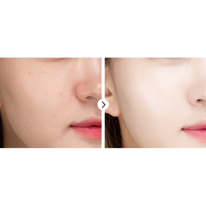 Tinh Chất Serum Xóa Nếp Nhăn, Ngăn Ngừa Mụn Venzen Dưỡng Ẩm, Thu Nhỏ Lỗ Chân Lông 15ml MS6050