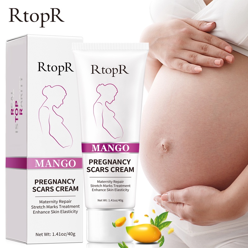 Kem Rtopr Cho Phụ Nữ Mang Thai Hỗ Trợ Giảm Sẹo Rạn Da Chống Lão Hóa Và Nếp Nhăn 40g