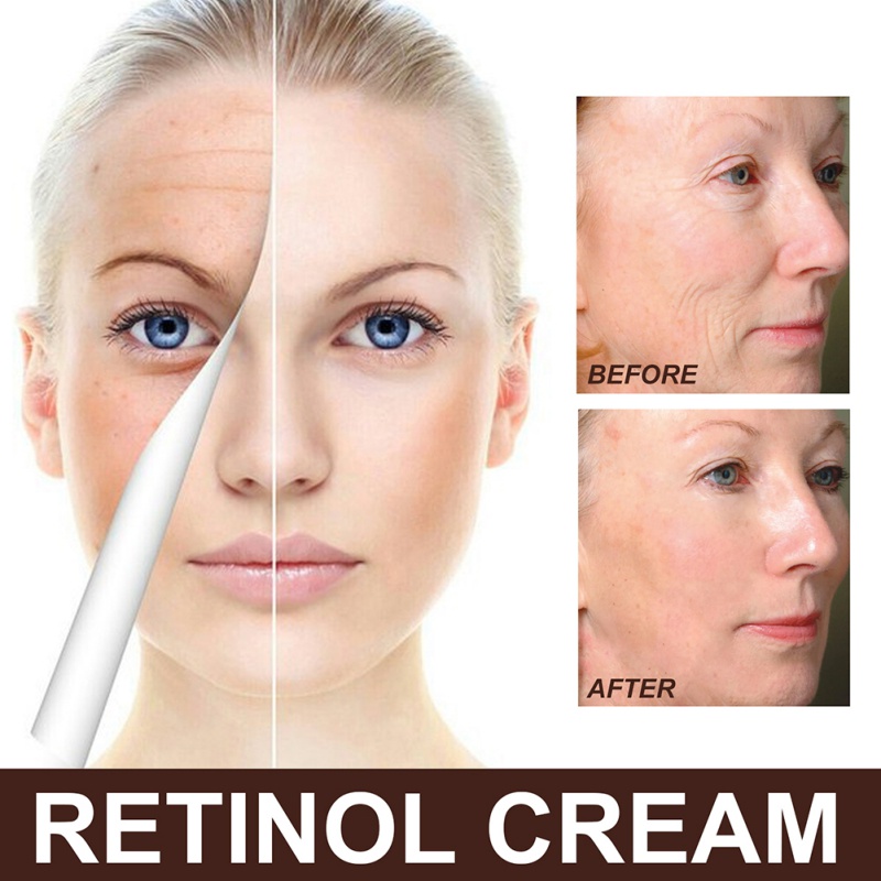 Kem Retinol 30g Chống Lão Hóa Xóa Nếp Nhăn Dưỡng Ẩm Làm Sáng Da