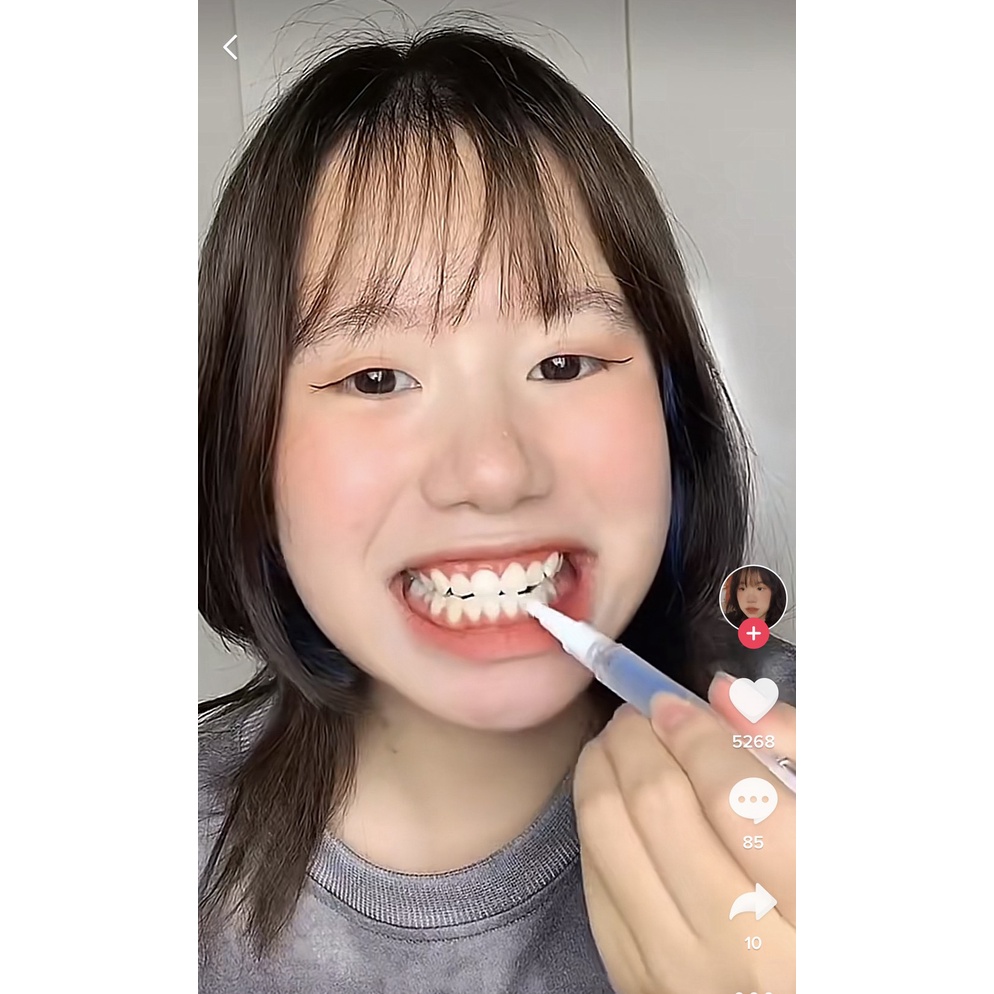 Bộ làm trắng răng tại nhà Smilekit LED - tiện lợi và an toàn nhất