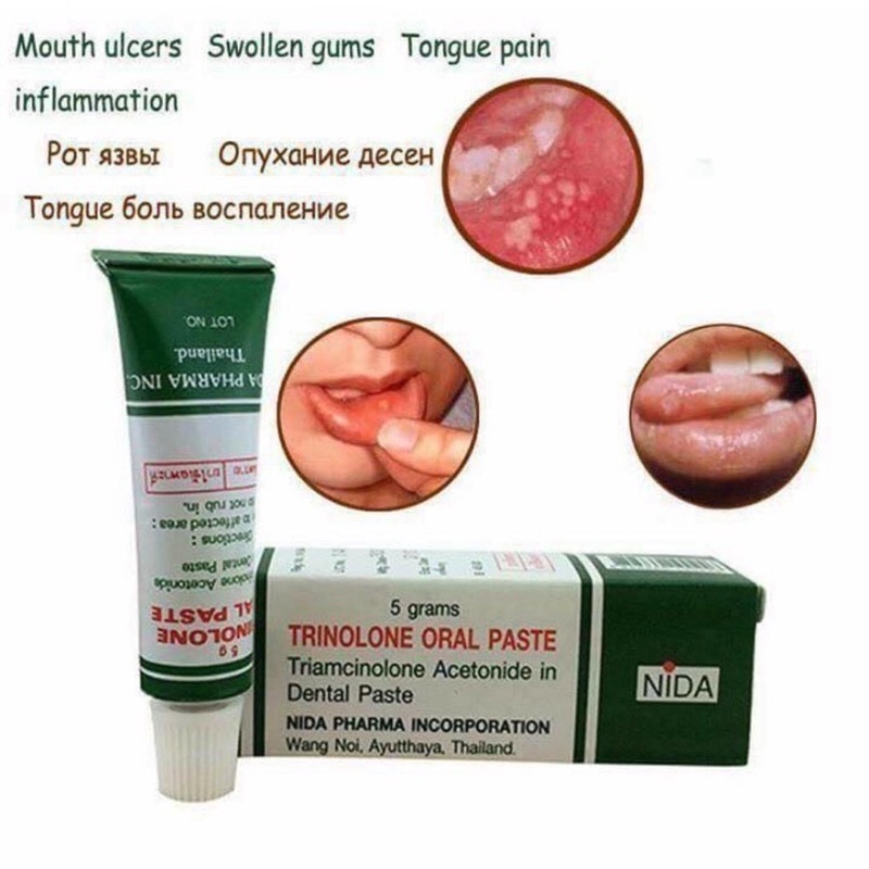 Thuốc thoa nhiệt miệng Thái Lan (Chuẩn hàng air)