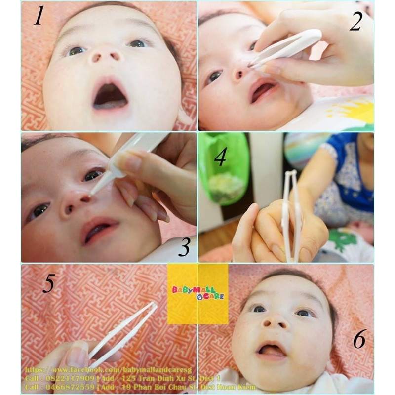 Gắp Rỉ Mũi Cho Bé, Vệ Sinh Mũi, Dụng Cụ Vệ Sinh Mũi Cho Bé Dễ Dàng, Không Đau, Không Xước Da