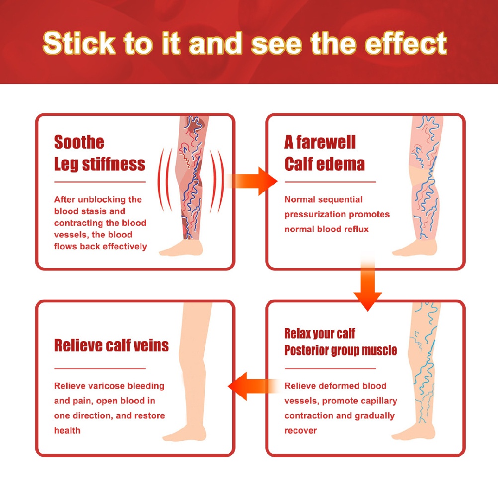 [Hàng mới về] Set 12 miếng dán giảm giãn tĩnh mạch chân nhện