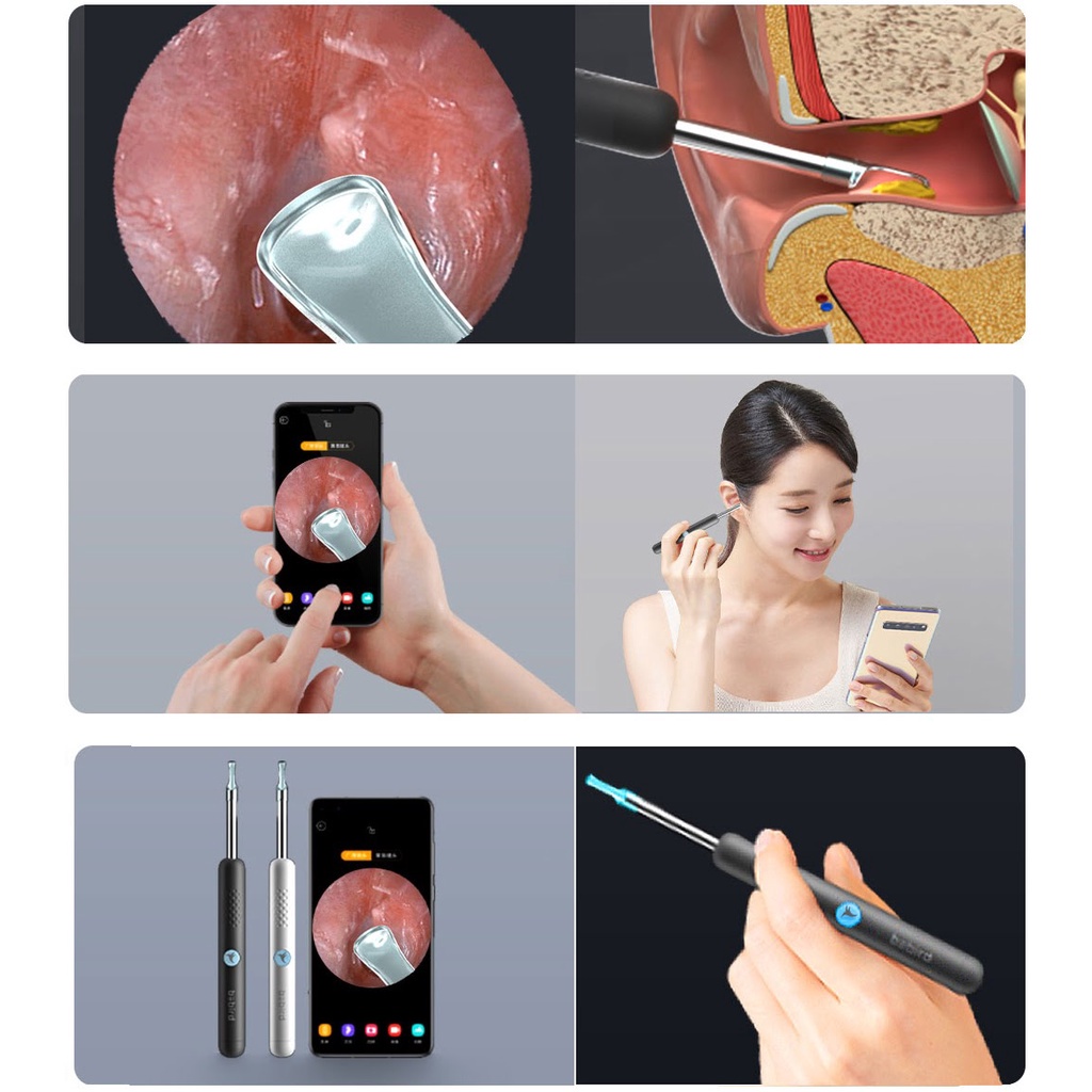 Dụng cụ lấy ráy tai nội soi Xiaomi Bebird R1-Máy lấy ráy tai có đèn kèm camera thông minh-Kết nối điện thoại