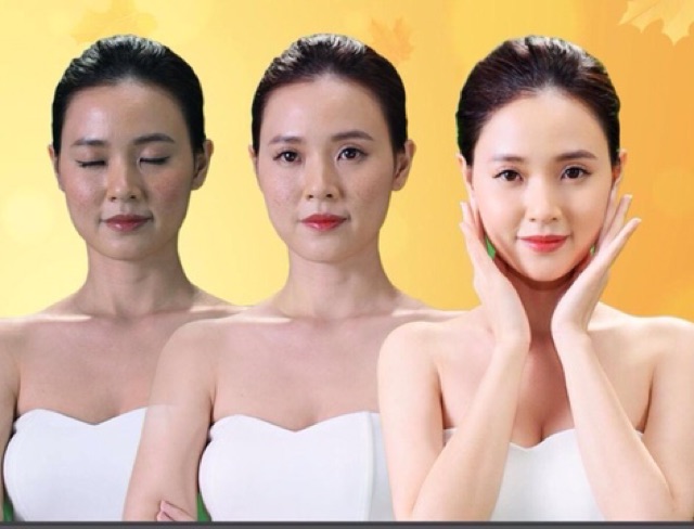 SERUM ĐẶC HIỆU NÁM VALENTINE LỌ 10ML - SAO THÁI DƯƠNG chính hãng