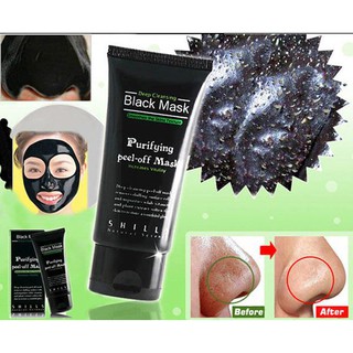 Kem lột mụn cám, mụn đầu đen Black Mask