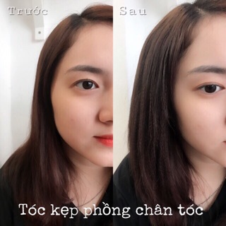 Kẹp tóc phồng