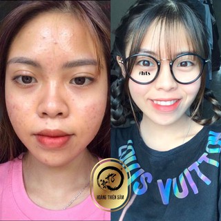 Combo Hoàng Thiên Sâm ⚡ Freeship⚡ (Bột rữa mặt và tinh chất Hoàng Thiên Sâm)