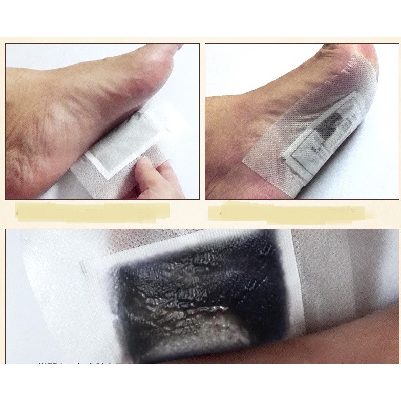 HỘP 50 MIẾNG DÁN CHÂN NGẢI CỨU THẢI ĐỘC CỦA BẮC KINH BIOAQUA | BigBuy360 - bigbuy360.vn