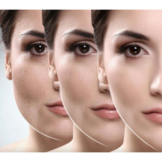 Kem Massage Thon Gọn Tạo Mặt V-Line Giảm Nọng Cằm