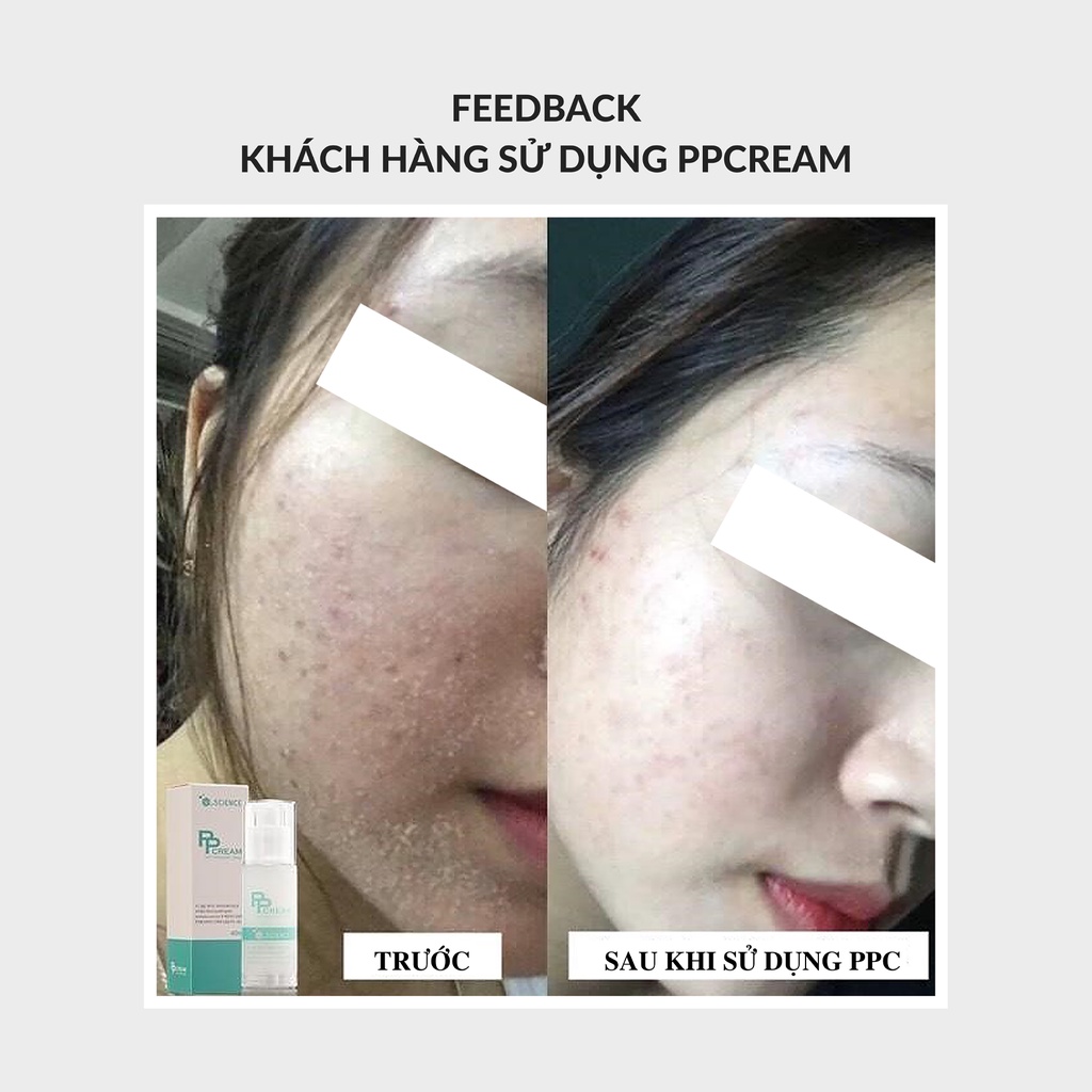 KEM TÁI TẠO CHUYÊN SÂU VÀ PHỤC HỒI DA TỔNG THỂ PPC - POST PROCEDURE CREAM