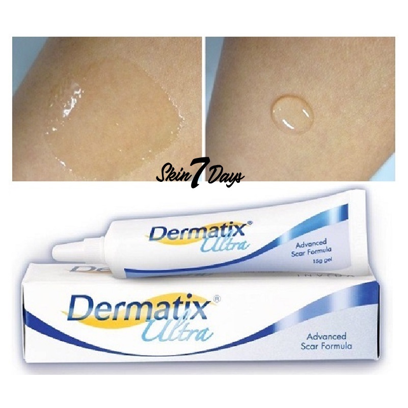 Kem Trị Sẹo Công Thức Nâng Cao Ultra Dermatix
