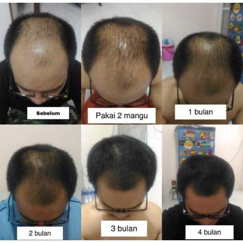 Chai Xịt Dưỡng Tóc Chống Rụng Tóc Dung Tích 120ml