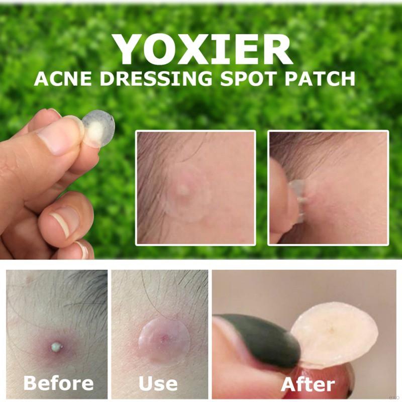 Face Patch Gel Patch Face Skin Care | BigBuy360 - bigbuy360.vn