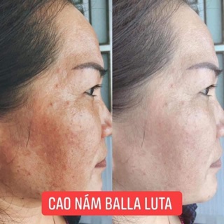 COMB CAO NÁM BALLA LUTA