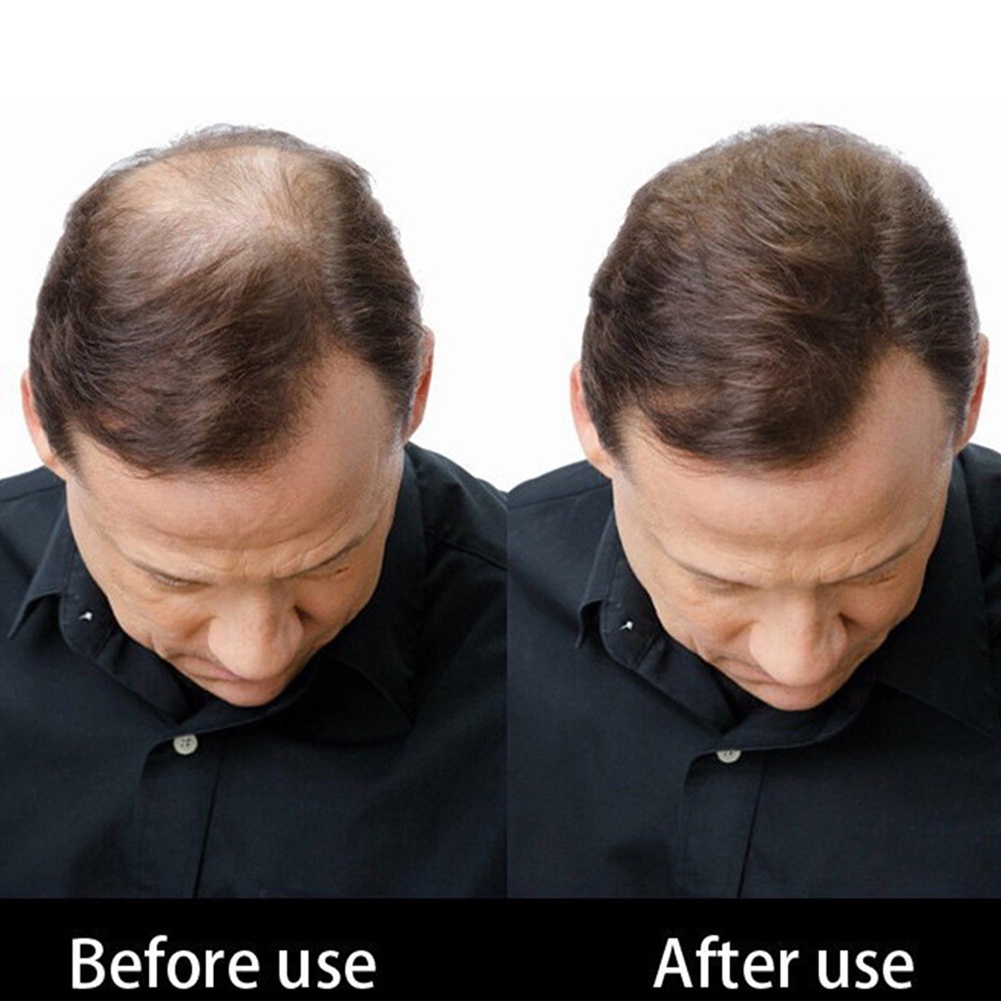 Phấn phủ che khuyết điểm dành cho tóc thưa 27.5g