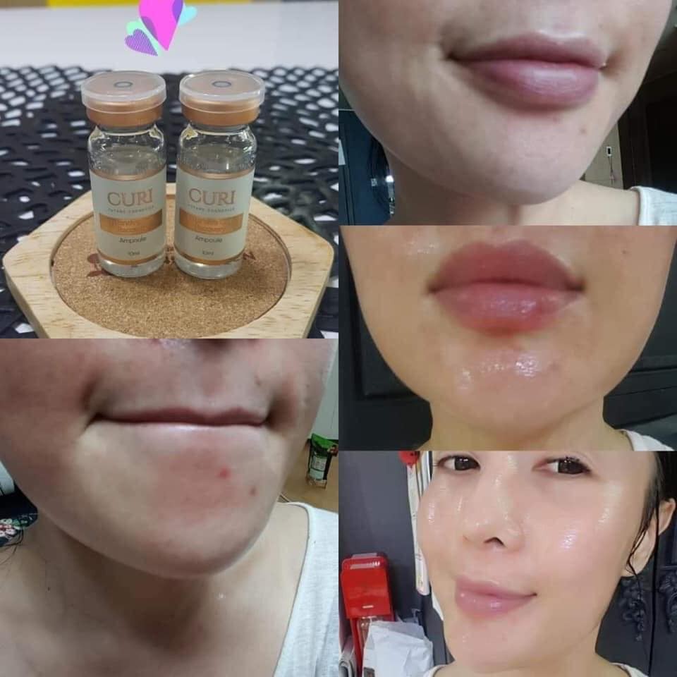 1 ống Tế bào gốc tươi Curi Siêu căng bóng, trắng sáng, mờ thâm | BigBuy360 - bigbuy360.vn