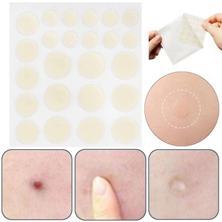 Miếng dán mụn Cosrx Acne Pimple Master Patch Epi Cosmetics
