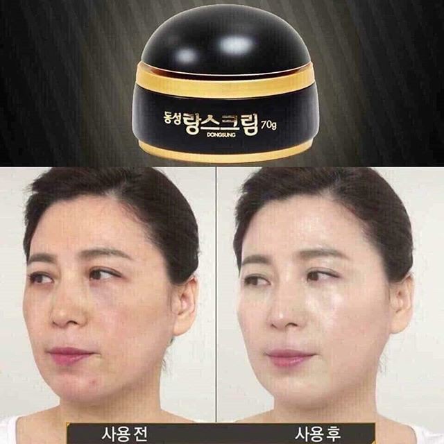 Kem giảm Nám Dongsung Rannce Cream Mini 10g, 50g