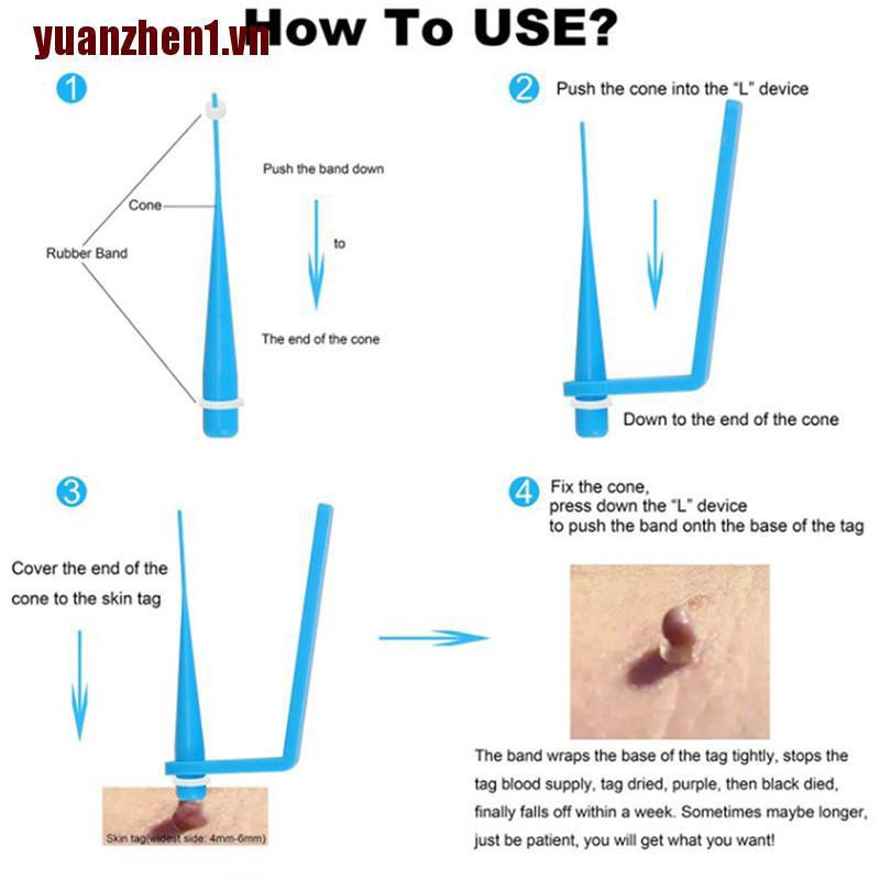 [Yuanzhen1] 20 Dây Cao Su Loại Bỏ Mụn Cóc Không Độc Hại Chăm Sóc Da Mặt
