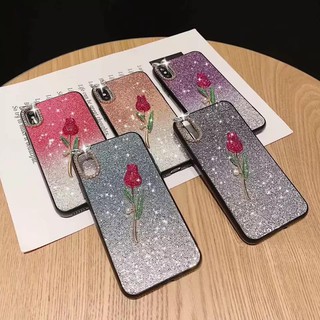 ỐP HOA ĐÁ RUBY