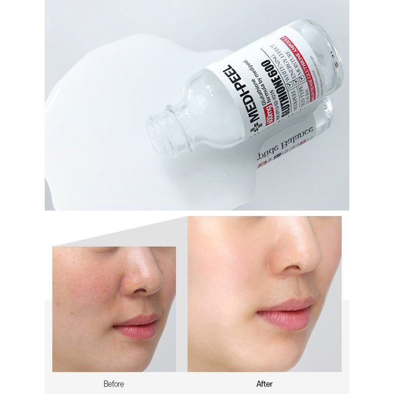 Tinh Chất Dưỡng Trắng Medi Peel Glutathione 600 White Ampoule 30ml
