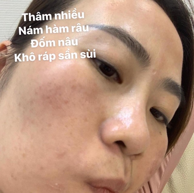 TẾ BÀO GỐC VẠN NĂNG COSMEHEAL SUPER SHINE CĂNG BÓNG - TRẮNG DA CẢI THIỆN SẸO RỖ