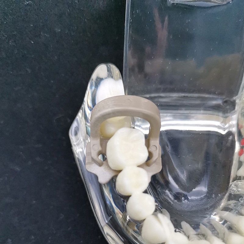 [Hàng mới về] Bộ 4 cái kẹp cao su resin chỉnh hình nha khoa làm thí nghiệm nghiên cứu