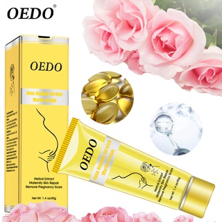 (Hàng Mới Về) Kem Trị Rạn Da Oedo Cao Cấp