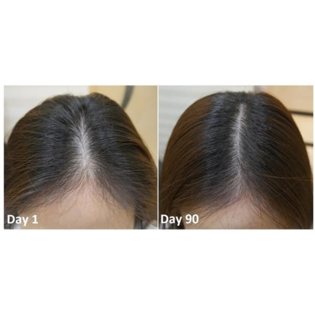 dầu dưỡng VASE.LINE HAIR TONIC